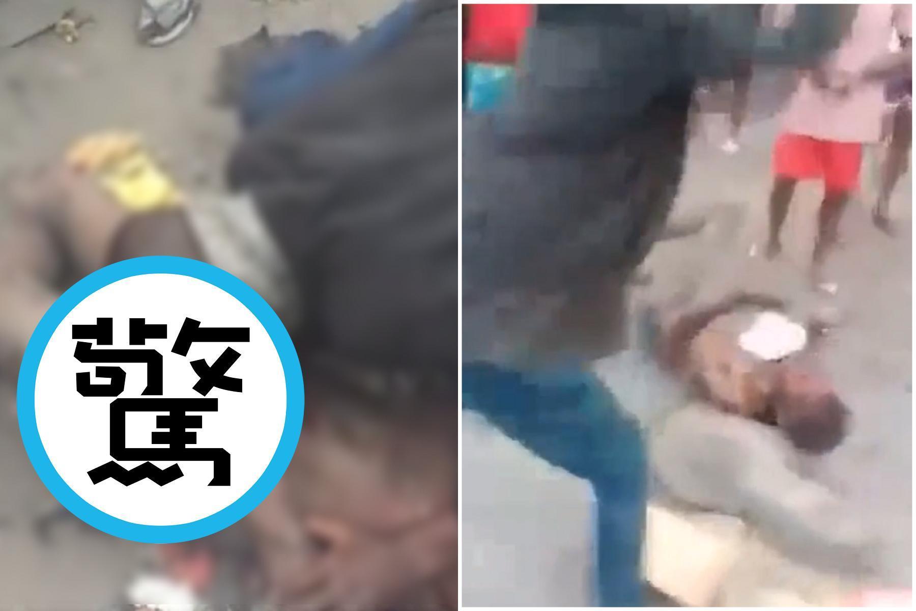 驚悚慎入!小偷慘被動私刑,遭「盜陰莖集團」咬斷生殖器狠砸石。(翻自推特)