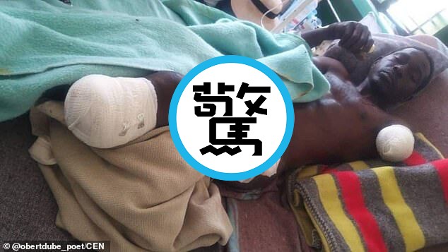 太驚悚！男跳河躲過大象追殺，下一秒慘遭鱷魚狠咬斷手斷腳。（翻自《每日郵報》）