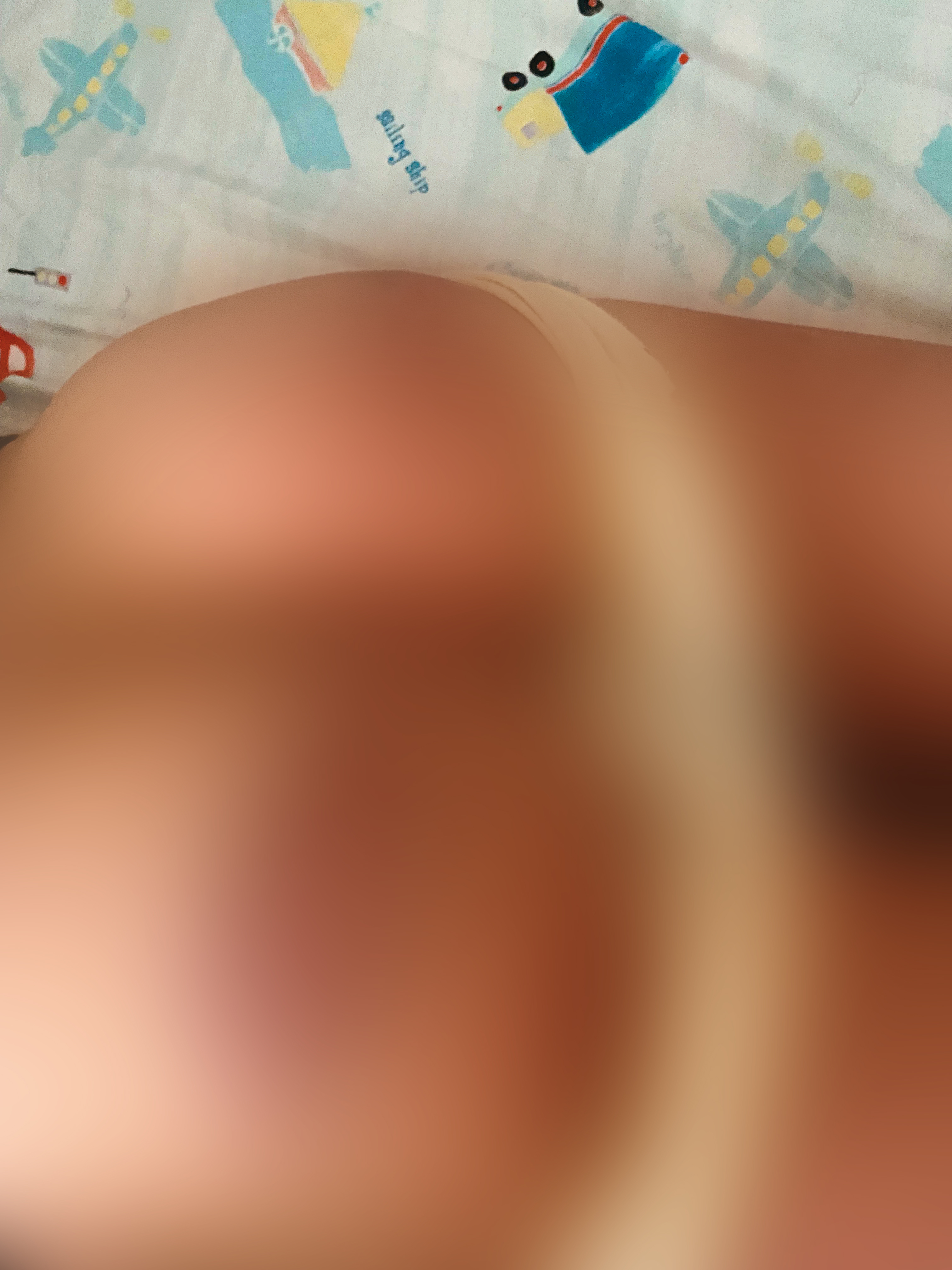 小傑(化名)被教練張兆祿連打了3天,臀部的瘀青與傷痕清晰可見。(讀者提供)