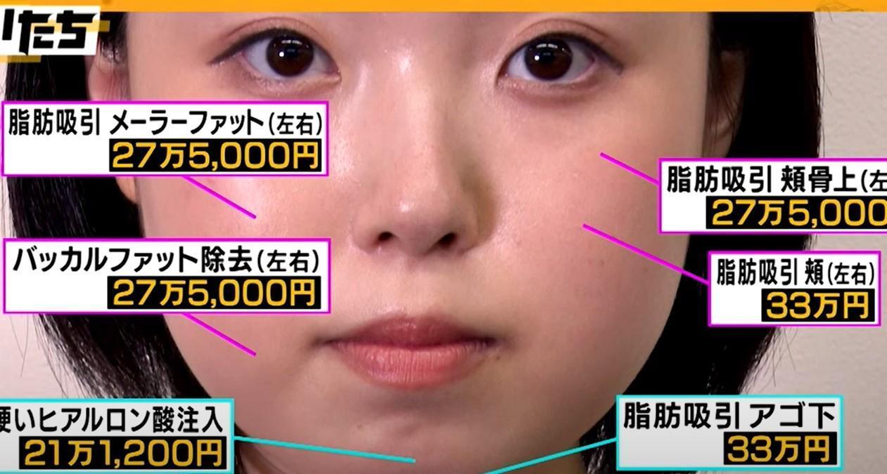 為了晉升「單體女優」，古賀裕子砸下百萬進廠修修臉。（翻攝自推特）
