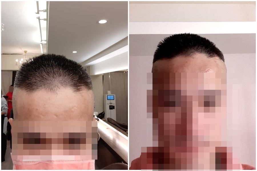 一名男網友到百元理髮卻被剪壞，憤而發文公審店家，引起網友熱議。（翻攝自爆料公社）