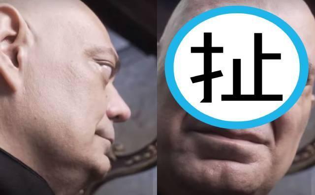 西德尼創下凸眼的金氏世界紀錄,狠甩上個保持者0.6公分。(翻攝推特)