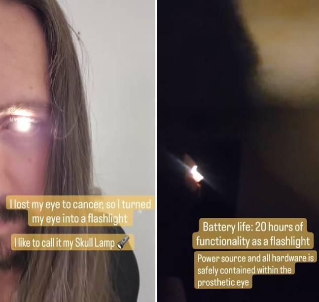 真人版魔鬼終結者！不幸罹癌讓他失去了眼睛，但他把自己的義眼改造成會發光的瞳孔。（翻攝IG@bsmachinist）
