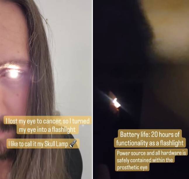 真人版魔鬼終結者！不幸罹癌讓他失去了眼睛，但他把自己的義眼改造成會發光的瞳孔。（翻攝IG@bsmachinist）