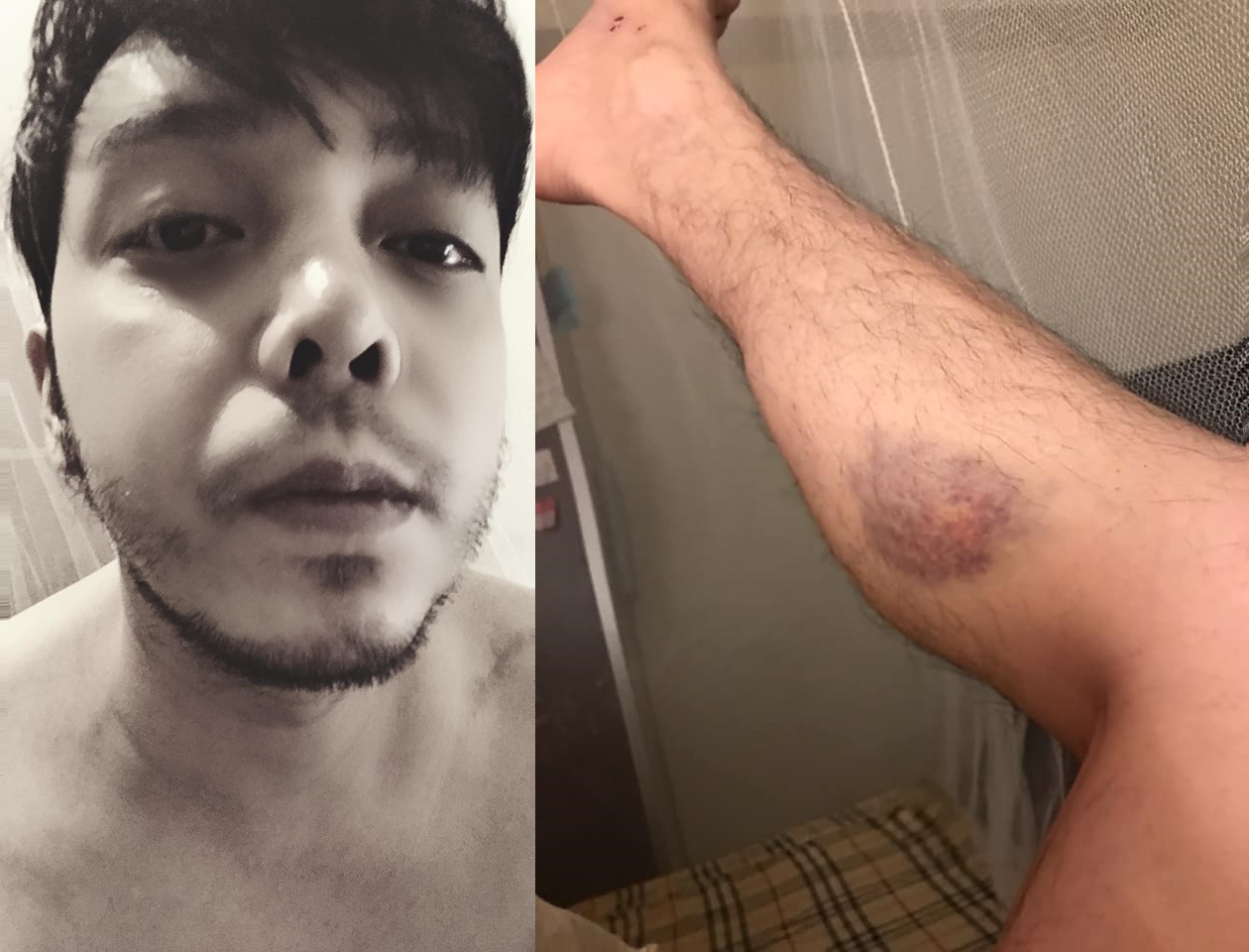 之前曾傳菌血症一度病危,小炳突宣布簽署「放棄急救」「死後器捐」。(翻攝小炳臉書)