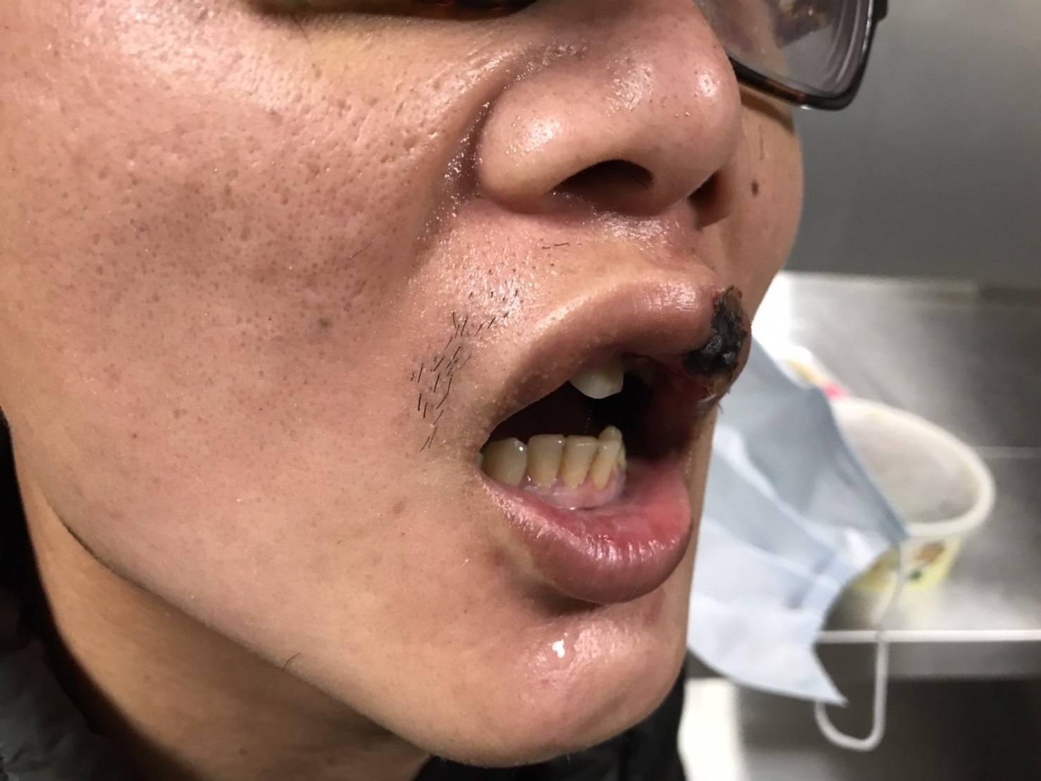 被害人遭凌虐。(警方提供)