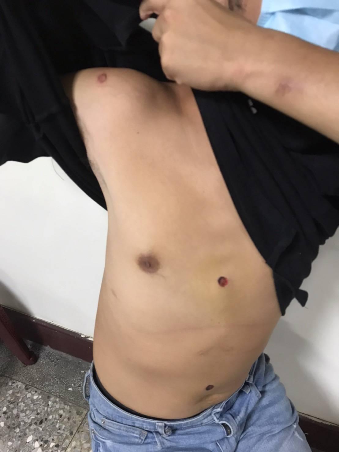 被害人遭嫌犯施虐。(警方提供)