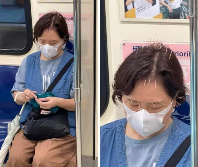 陳沂的媽媽搭捷運扎了滿頭針，引發網友熱議。（翻攝自臉書）