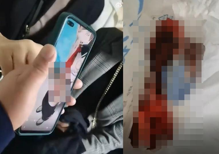 中國四川棠湖中學實驗小學驚傳男童遭同學割傷下體,但警方出面駁斥,表示為同學嬉鬧受傷。(翻攝微博)