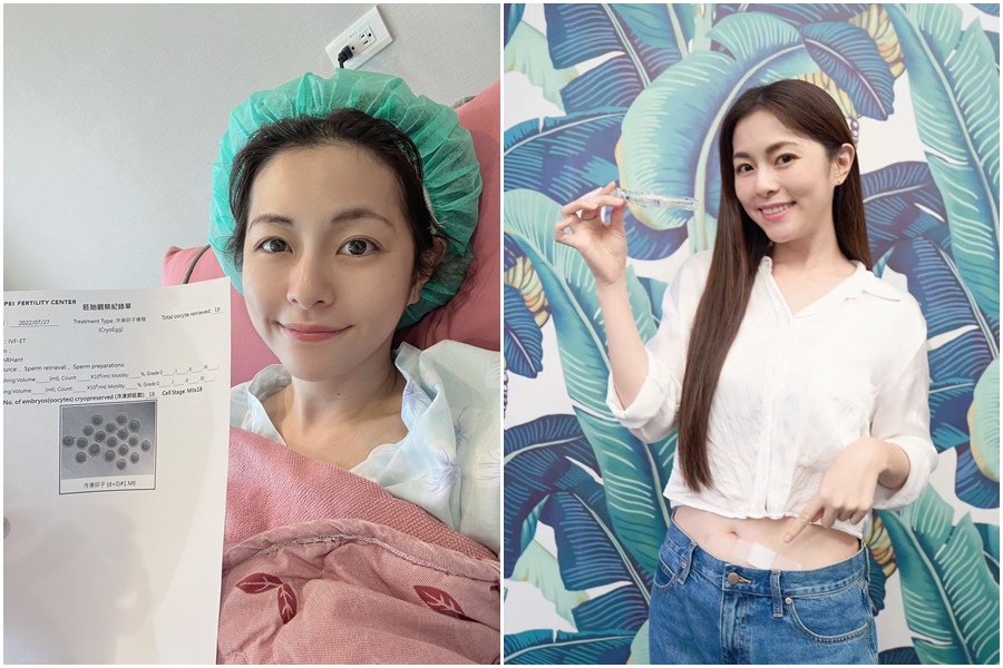 任容萱選最佳年紀凍卵，凍卵之路從容不迫。（星星向容提供）
