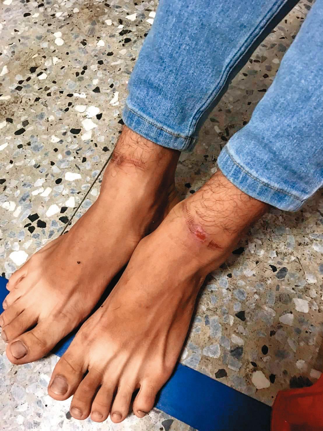 肉票被救出時滿身傷痕,警方緊急將他送醫。(警方提供)