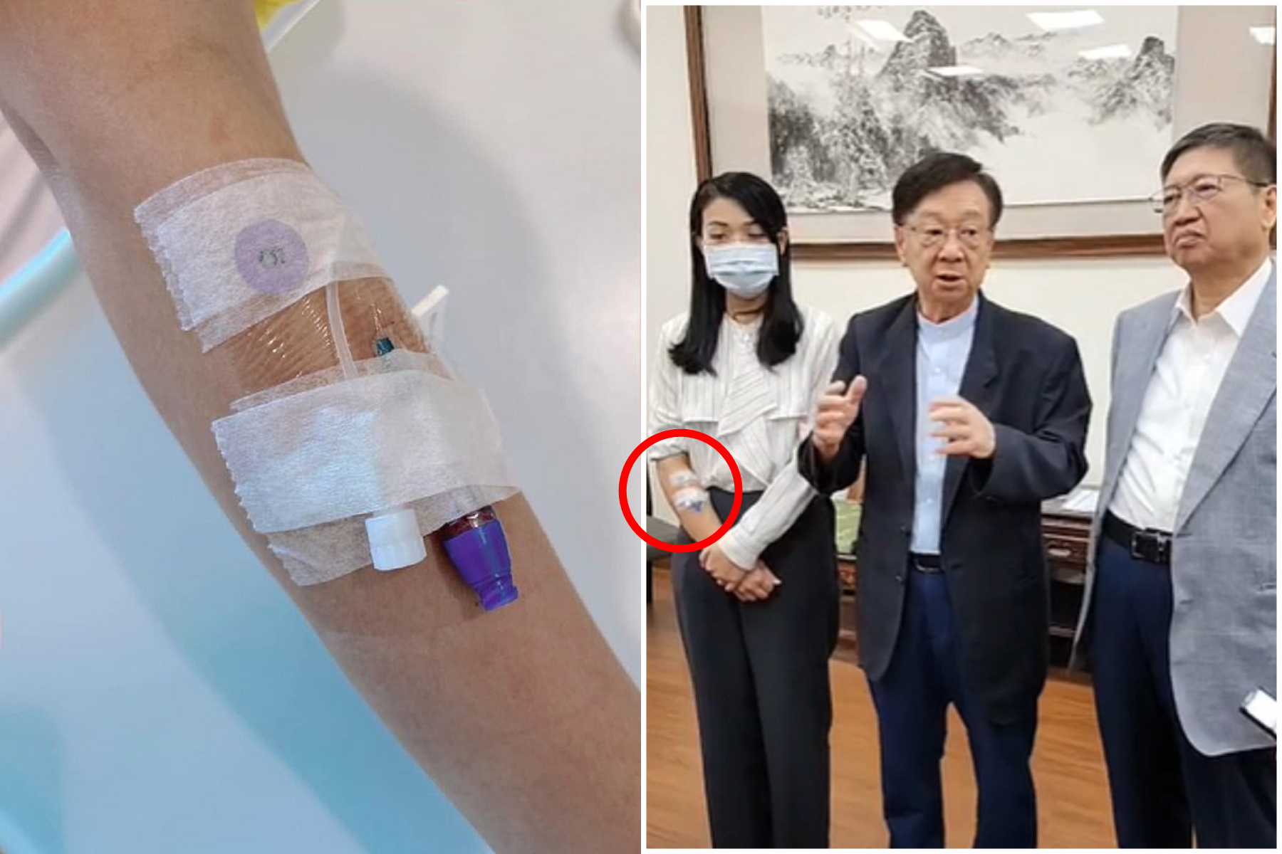 高虹安出院啦!「點滴還沒打完」手臂黏紗布針頭,密會新竹縣長楊文科(右),中間為宣明智。(翻自臉書+《聯合報》直播畫面)