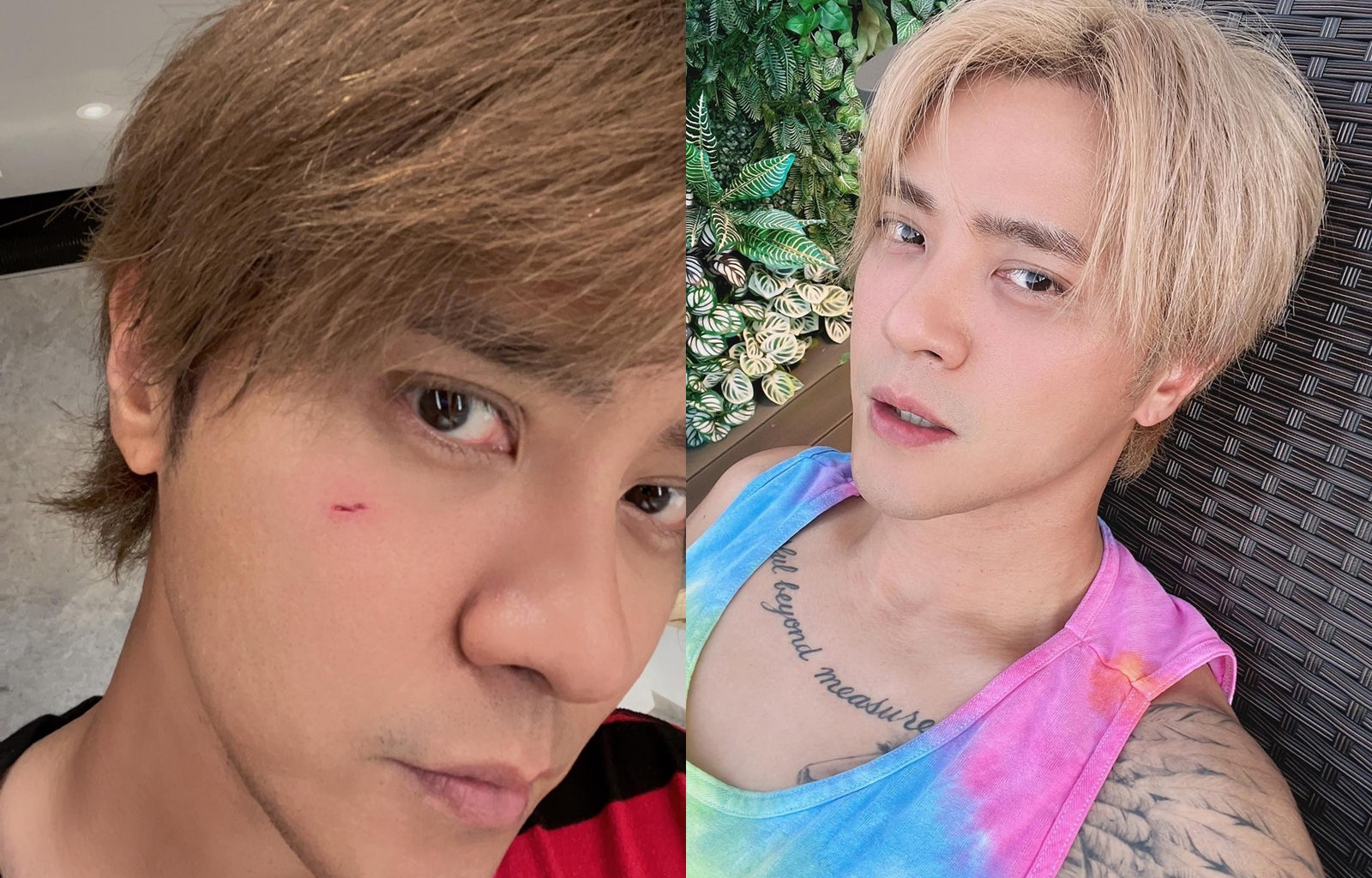 羅志祥破相，略為鬱悶。（翻攝自小豬臉書、IG）