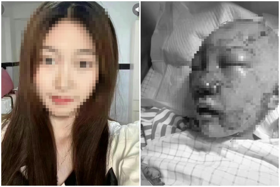 中國一名徐姓網美日前在公廁遭尾隨變態襲擊險些喪命。（翻攝自微博）