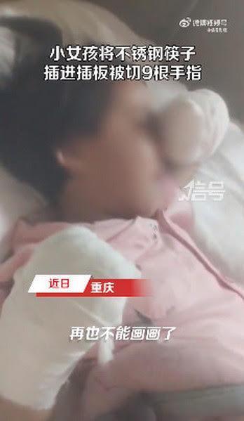 小女孩切除9根手指後,雙手裹上紗布,難過舉手拭淚。(翻攝微博@觀察者網)
