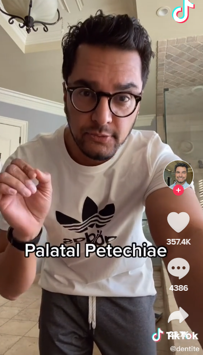 網紅牙醫在抖音解釋何謂顎部瘀斑。（翻攝TikTok@dentite）