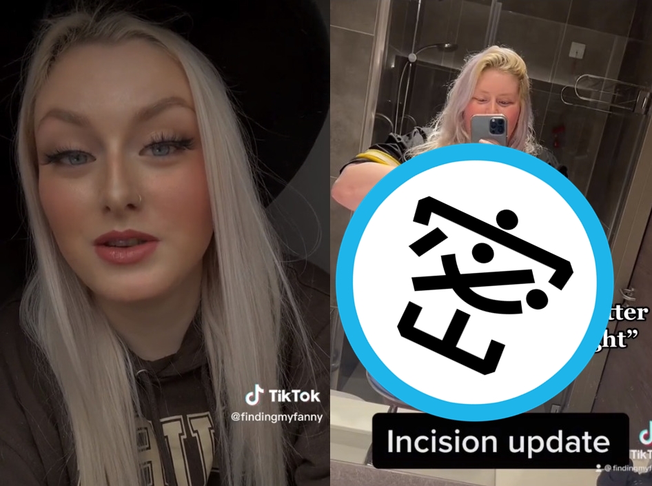 女大生梅根一度胖到150公斤，用學貸的錢動縮胃手術狂瘦一圈變成正妹。（翻攝抖音@findingmyfanny）