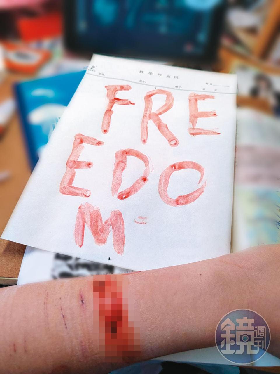 微信上有中國網友以血書響應白紙運動，自殘寫下Freedom。（受訪者提供）