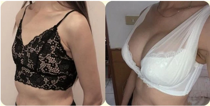人妻分享婆婆隆乳手術前後對比照片，原本穿內衣胸前扁平，術後胸部罩杯躍升，十分豐滿。（翻攝《Dcard》）