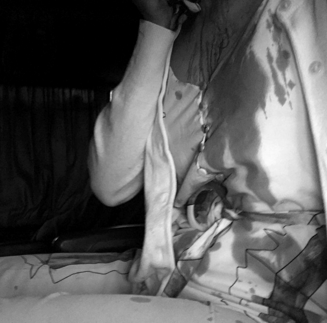 史蒂芬妮遭受攻擊，當下血流滿面，身上衣服沾滿血跡。（翻攝IG@teffi_nh）