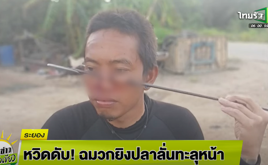 驚!男用魚叉捕魚反射中自己,122公分長刺貫穿頭顱大爆血。(翻自《Thairath Online》)