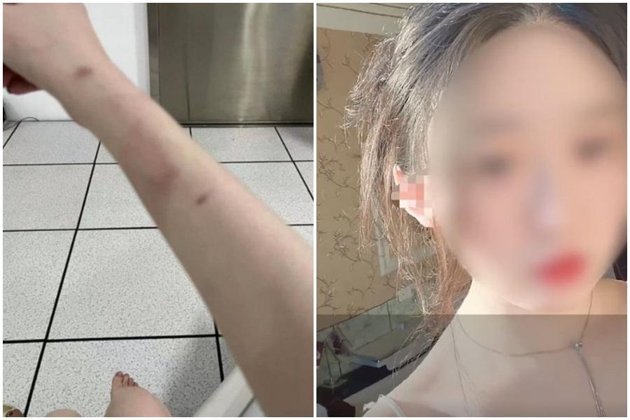 中國江西南昌一名女大生近日勇敢表示遭輔警猥褻,卻沒想到事後遭強制送進精神病院2個月。(翻攝自秒拍)