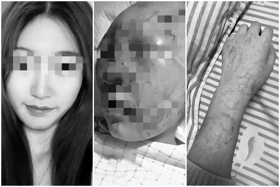 浙江20歲抖音網美「仙氣樂蘊」10月底在公廁上完廁所後,被一名噁男尾隨攻擊。(翻攝自瀟湘晨報)