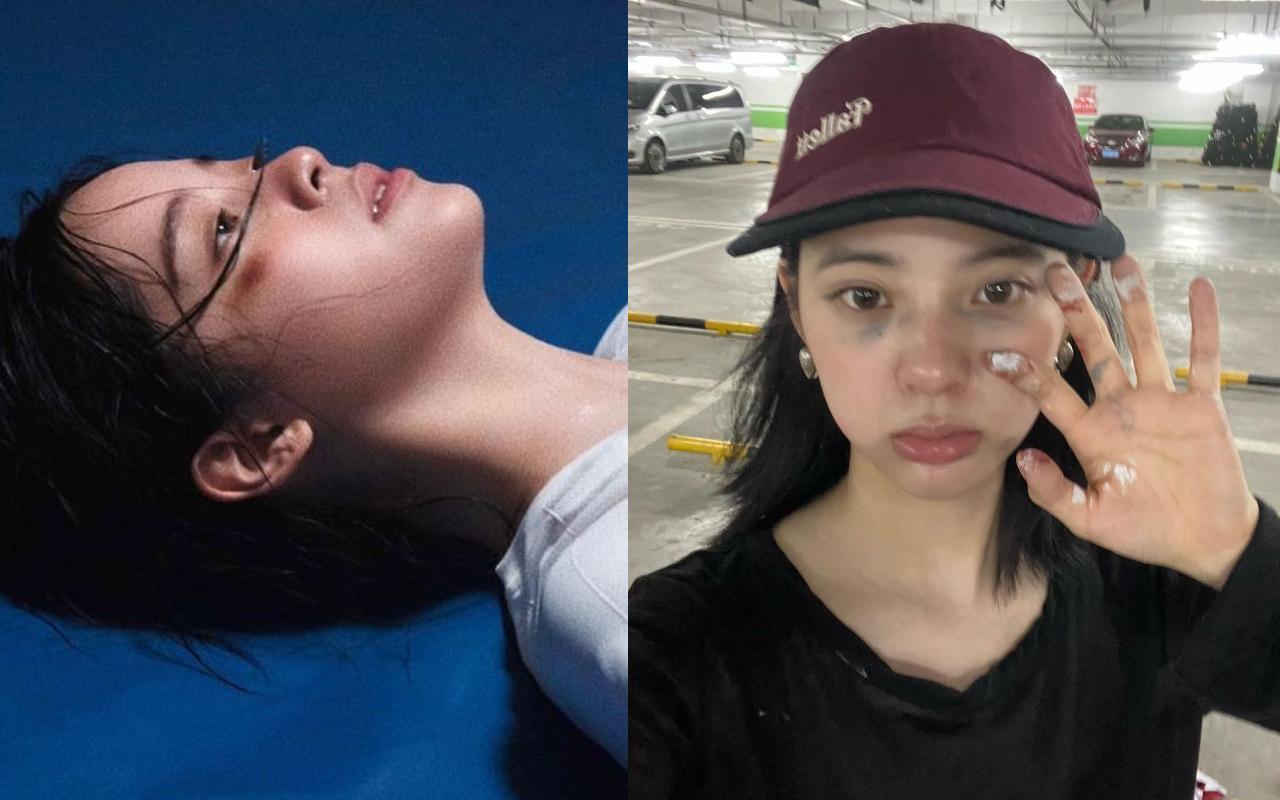 歐陽娜娜曝光被爆打到倒地躺平、雙眼烏青的照片。(翻攝自歐陽娜娜IG)