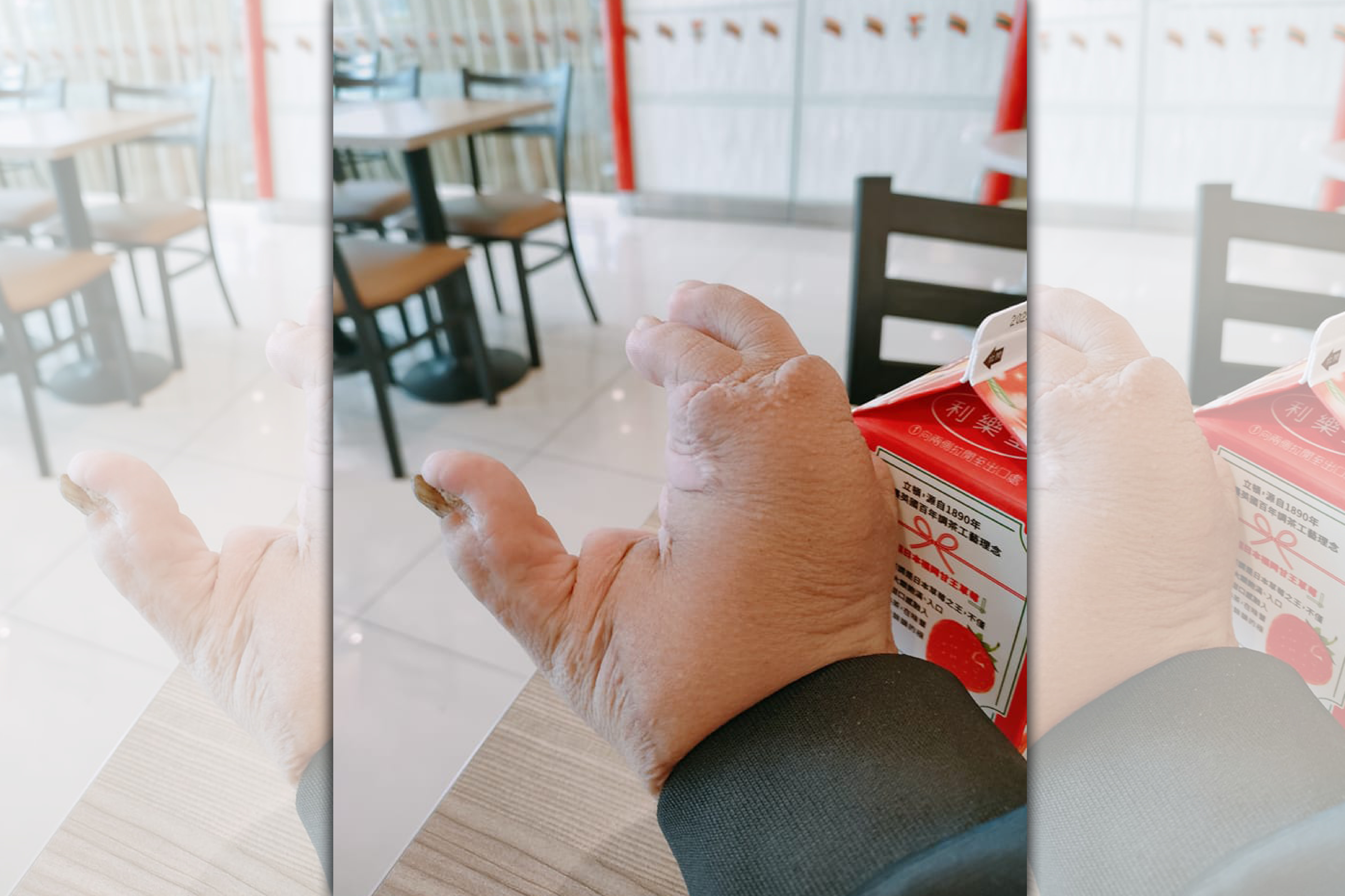 身障男遭童喊「你手長得很噁心」，但他的正向回應令萬人讚爆。（翻攝自爆怨公社）