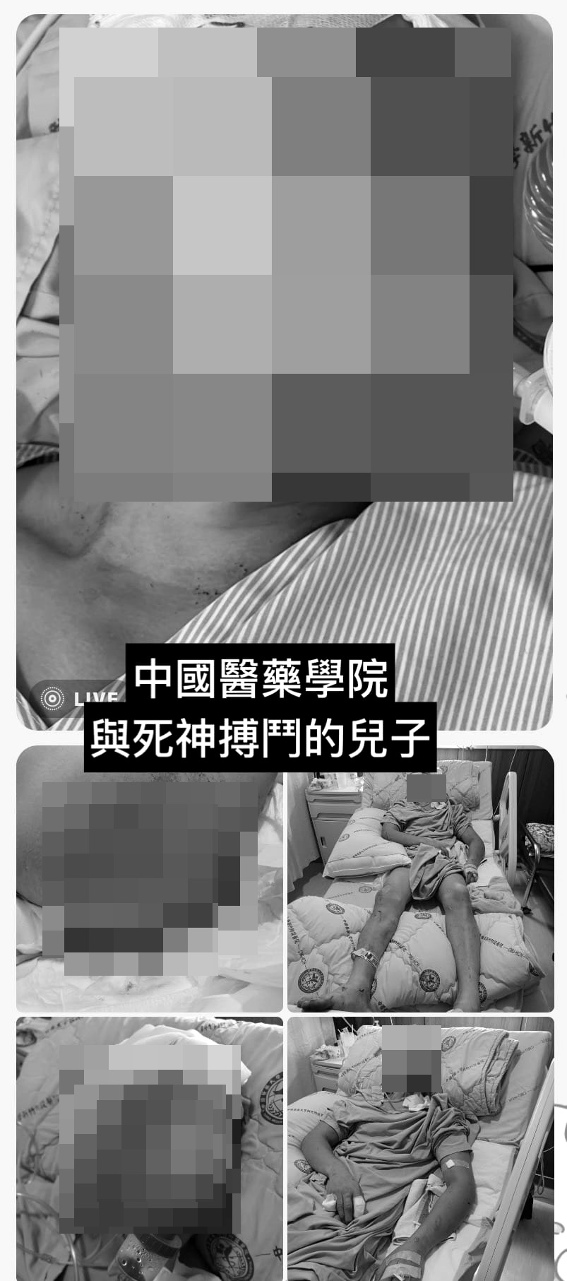 鍾母拍下仍在加護病房,與死神搏鬥的兒子,控訴警方放任動用私刑。(翻攝自爆料公社)