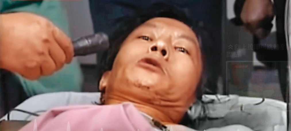 黃鴻寓中槍送醫，但表情及眼神仍十分凶狠。（東森新聞提供）