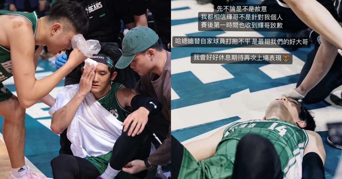 台啤看板球星兼隊長蔣淯安右眉骨撕裂傷縫了21針,並對本次流血事件高EQ回應。(翻攝自台灣啤酒英熊 TaiwanBeer HeroBears臉書、蔣淯安IG)