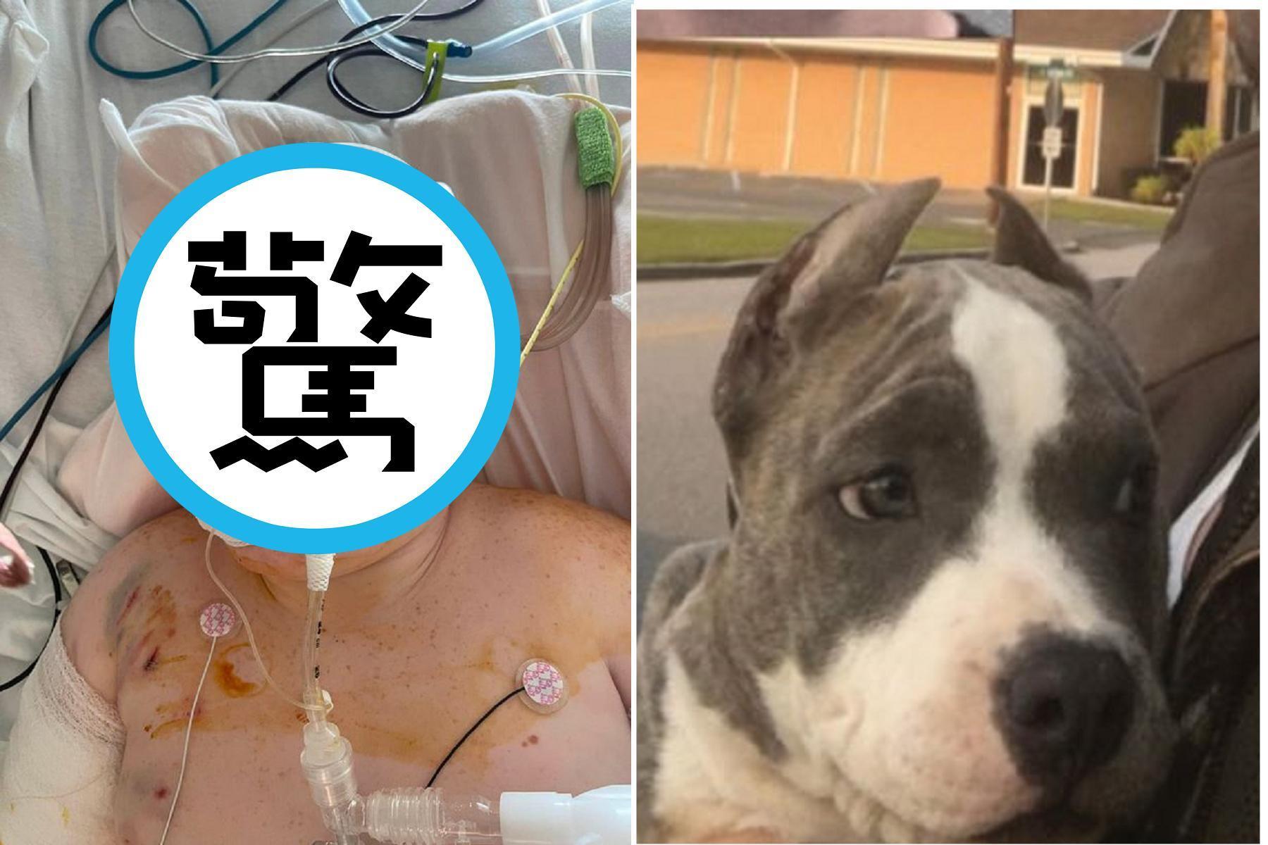 慎入!男童騎自行車慘遭3鬥牛犬「追殺」,頭皮全被狠咬撕爛重傷。(翻自《每日星報》)