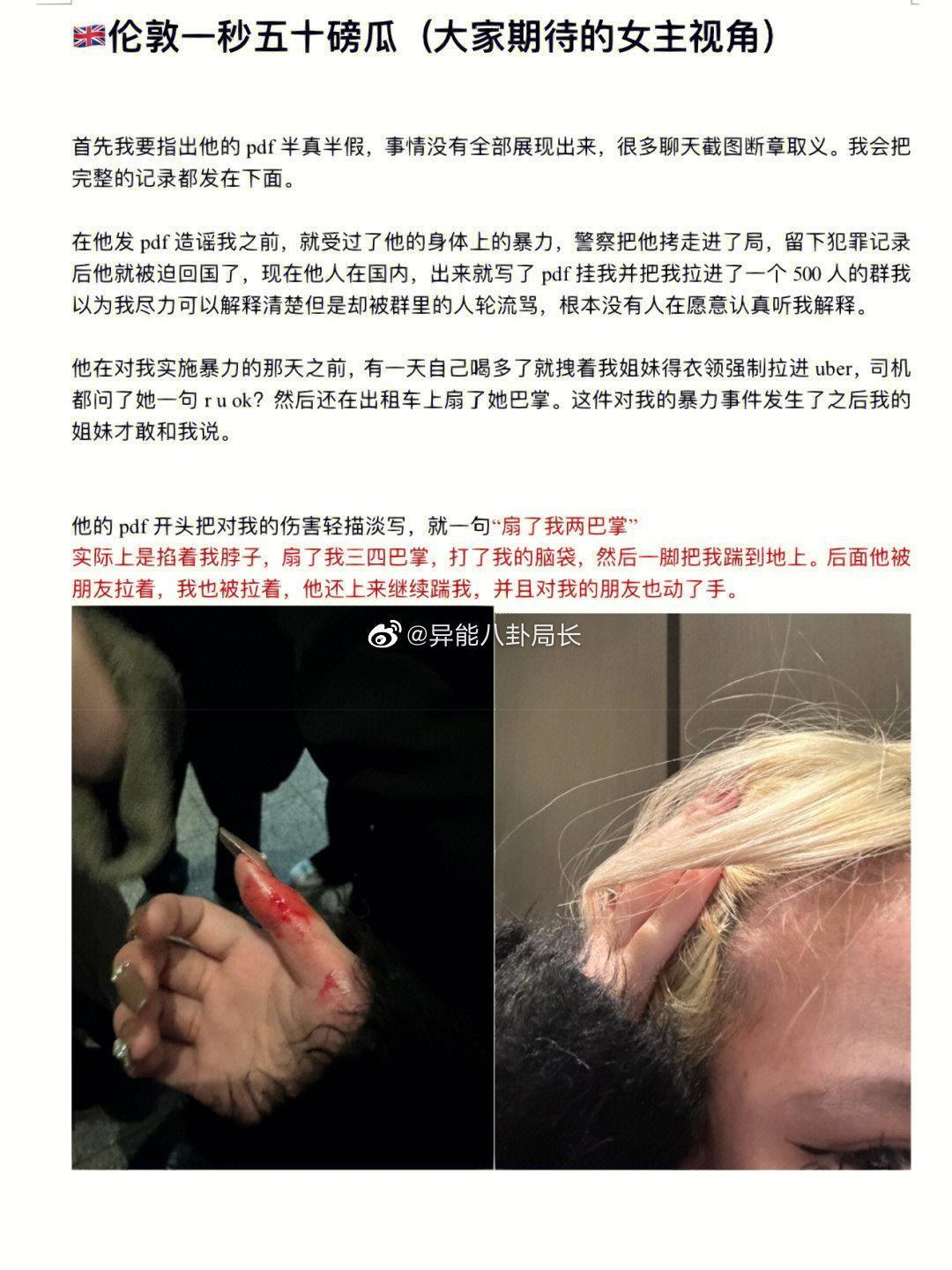 網美自爆自己遭富少暴力對待，朋友也遭殃。（翻攝自微博）