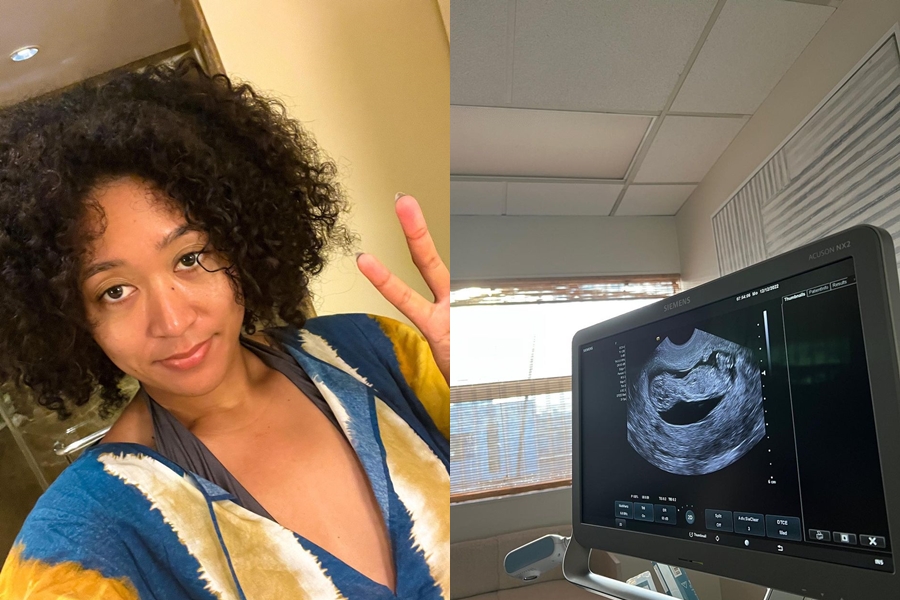 日本網球好手大坂直美在IG宣布自己懷孕的好消息。（翻攝自@naomiosaka IG）