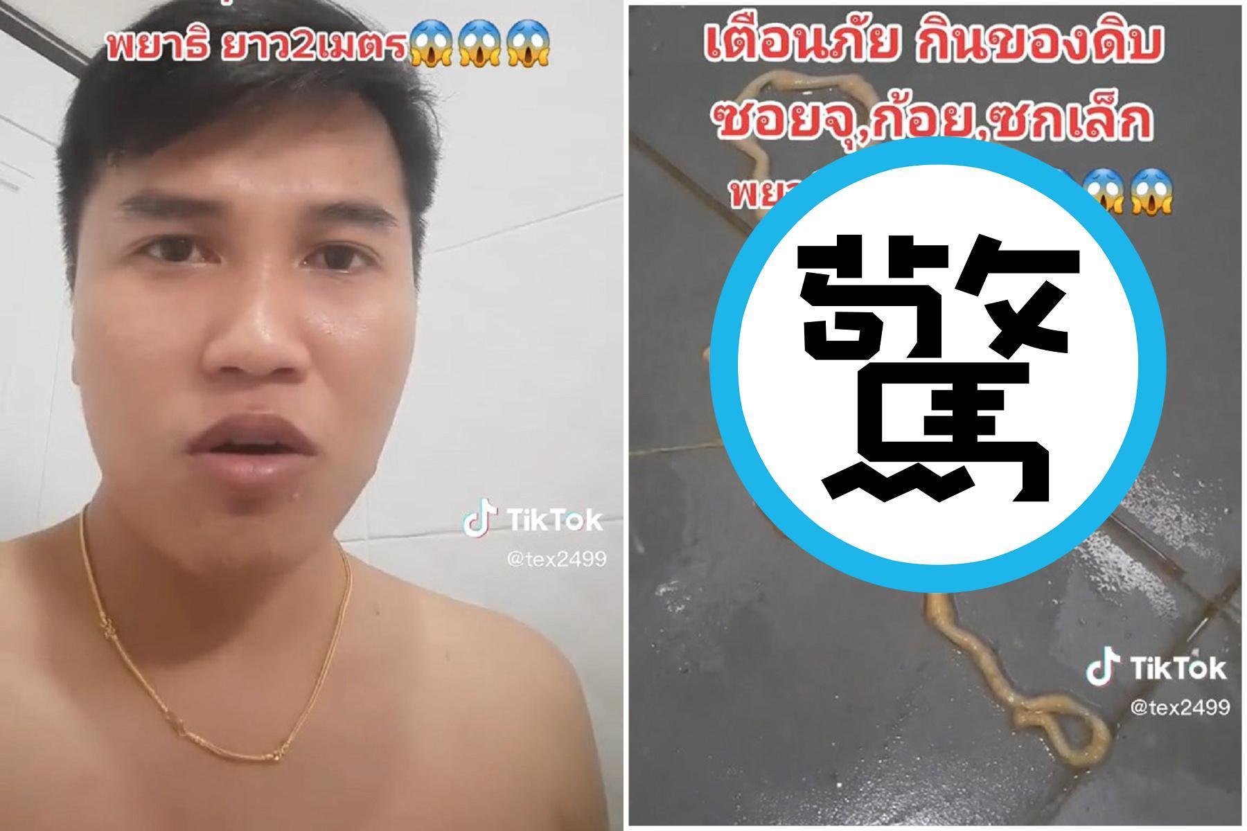 男下體被「督」，竟是肛門鑽出200公分蟲蟲！體內「煉蠱」至少3年。（翻自TikTok）