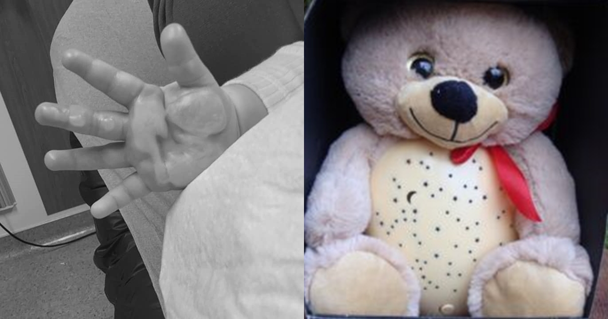 熊娃娃(右)突然發燙冒煙,抱著它睡覺的女嬰慘遭燙傷。(左圖翻攝自Karae Gordon臉書;右為網路圖片)