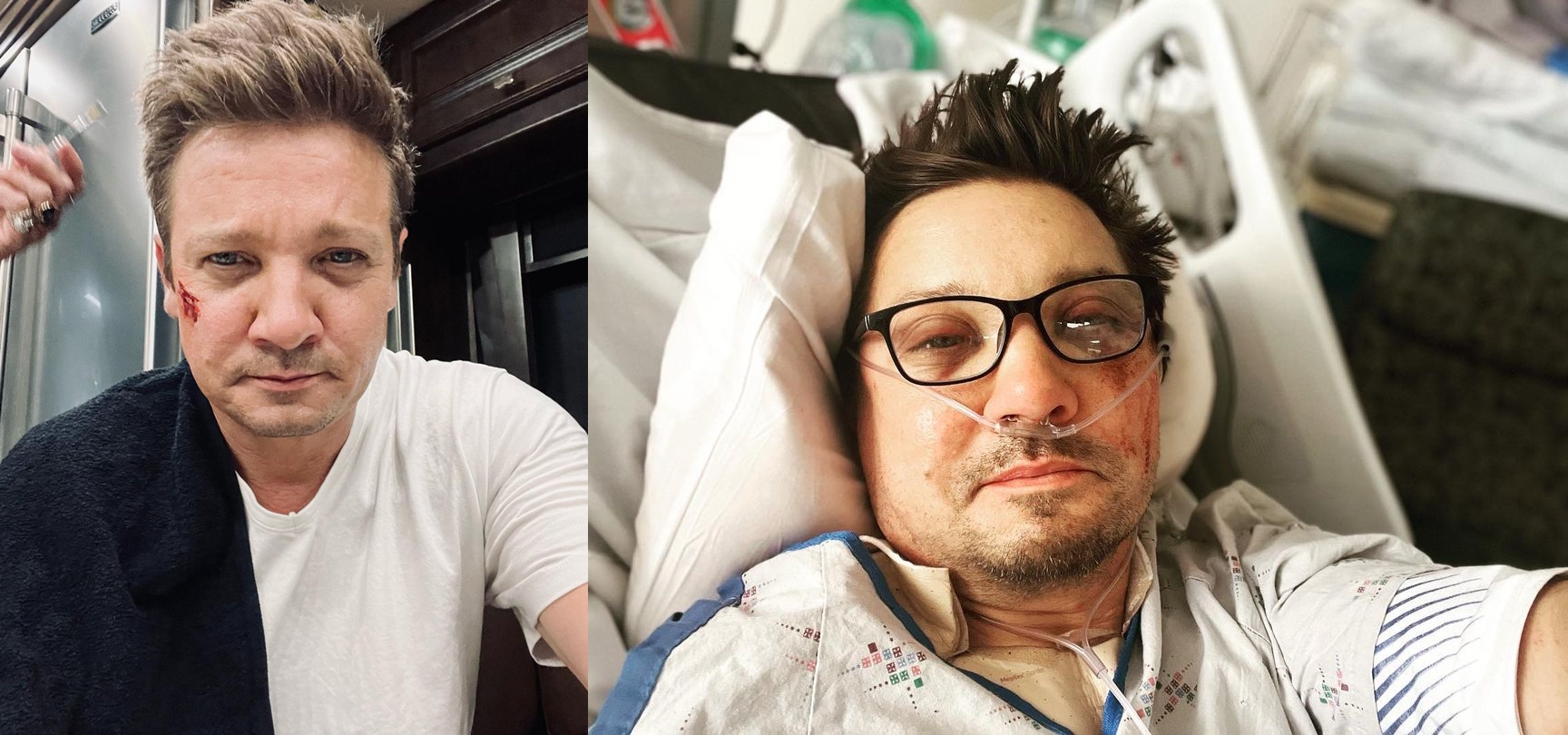 傑瑞米雷納日前遭鏟雪車輾過差點送命，但知情者爆料他的傷勢比外界所知更加嚴重，要2年才能康復。（傑瑞米雷納IG）