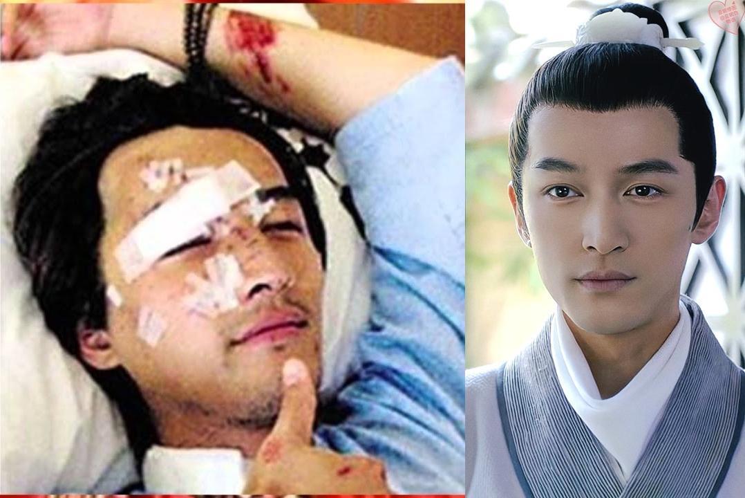 胡歌曾遭遇嚴重車禍,右半臉毀容,縫了上百針及進行10多次修復手術,雖仍見傷疤,但傷後主演的《瑯琊榜》仍火爆兩岸三地。(微博圖片)