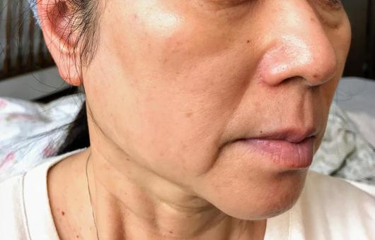 沒事亂挖鼻孔雖然舒壓,不過有可能導致失明、毀容等恐怖後果。(圖 示意圖,photo-ac)