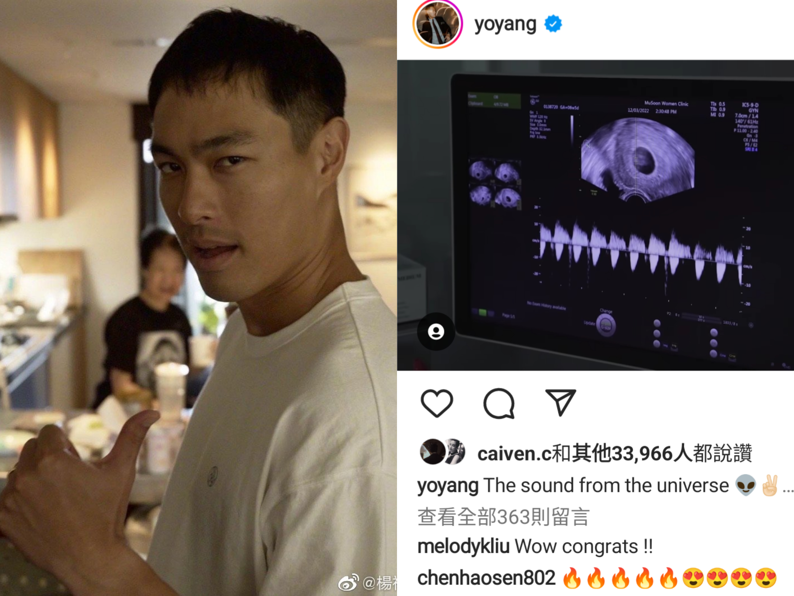 楊祐寧公開老婆超音波影片讚，宣布即將成為二寶爸。(楊祐寧IG)