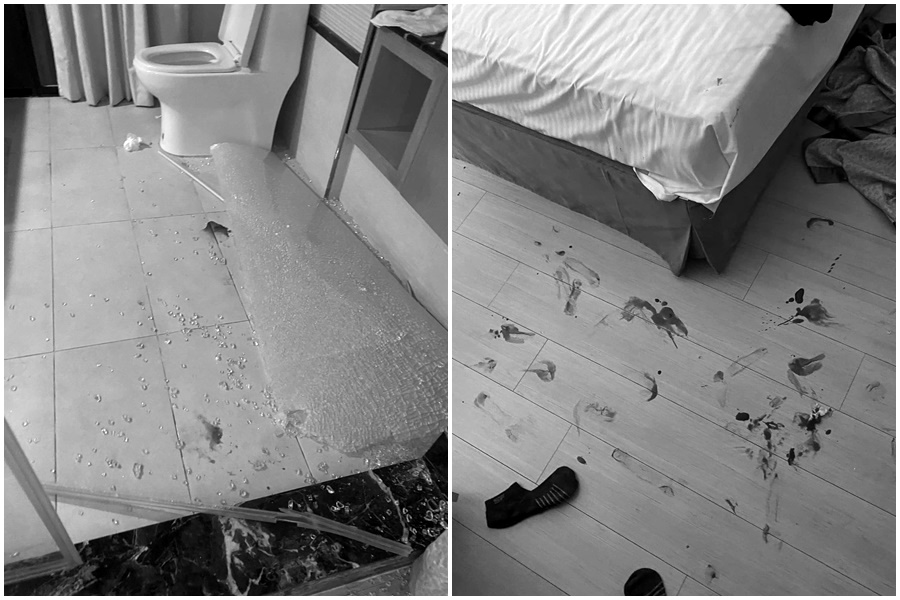 一名旅客爆料宜蘭某知名溫泉會館浴室玻璃門爆裂，導致他全身多處割傷。（翻攝自爆料公社）