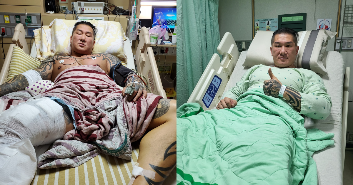 館長2020年8月遭槍擊（左），持續2年多的復健，今再度入院動手術（右）。（翻攝自飆捍臉書）