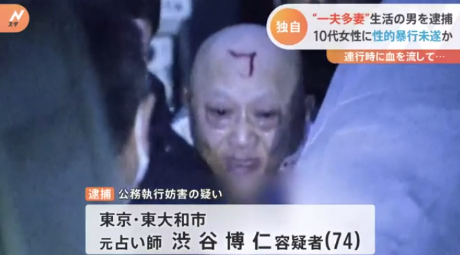 涉谷博仁遭警方逮捕，疑似因拒捕和警方發生衝突，造成頭頂流血。（翻自推特）