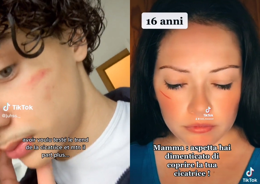法國青少年在抖音瘋傳「傷痕挑戰」的自虐影片。（翻攝抖音@mvlikoff_）
