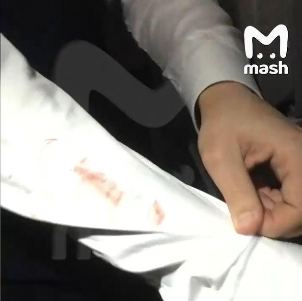 一名男性空服員被摩絲維提娜亂咬濺血。（翻自《每日郵報》）