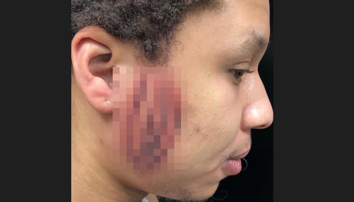 刺青師原本勸退男顧客要求，但男子思考一個月後仍上門希望付諸實行。（翻攝IG@mikey5thousand）