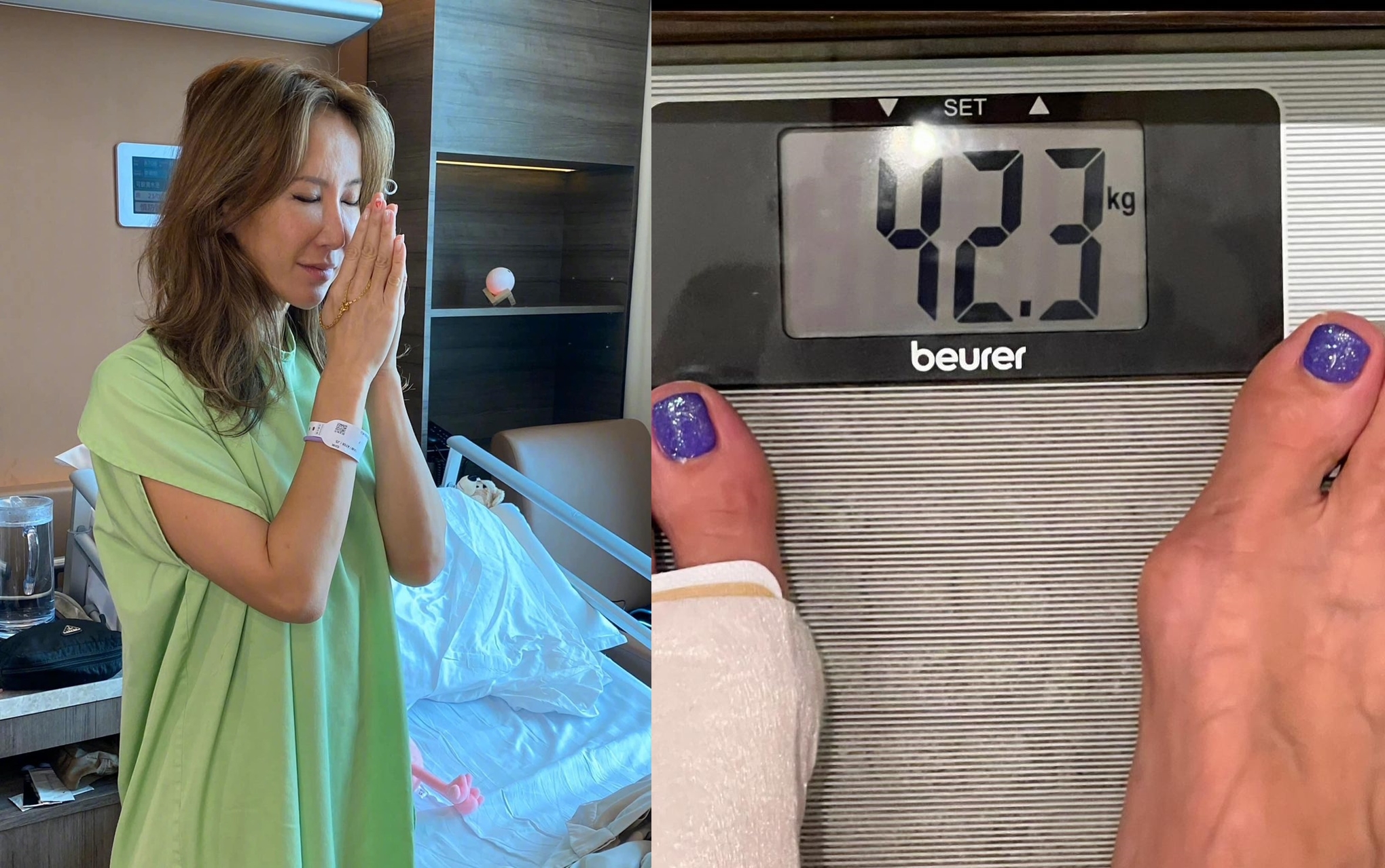 Coco李玟23日在社群上分享多年來她受天生腿部缺陷所苦。其實過去李玟的PO文中就曾拍到，站在體重計上，左腳裹成一大包。（翻攝自李玟臉書）