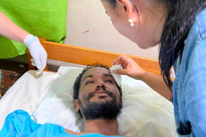 野外求生大挑戰！男打獵受困亞馬遜雨林31天，吃蟲啃蚯蚓喝尿幸運存活。（翻自telemundo.com）