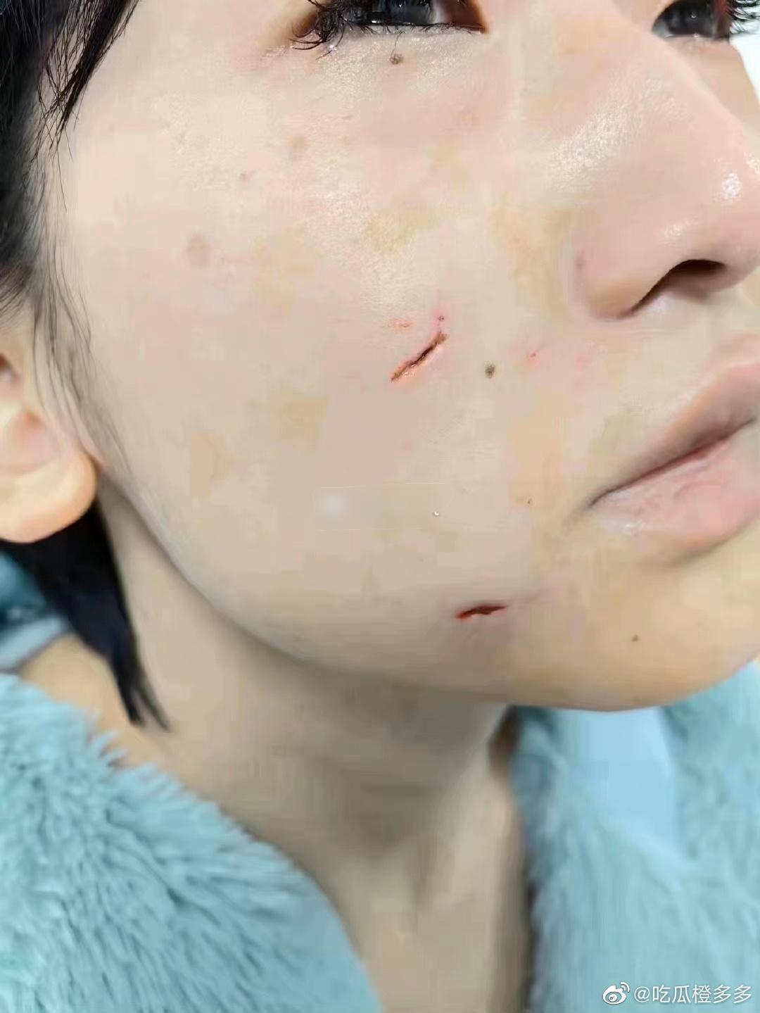妹子事後上傳破相照。(翻自微博)